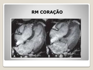 RM CORAÇÃO
 