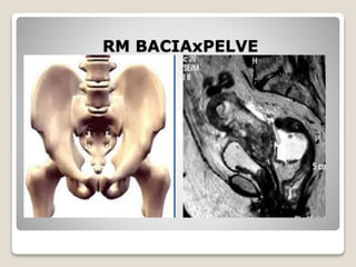 RM BACIAxPELVE
 