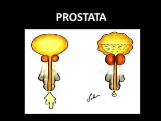 PROSTATA
 