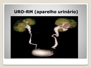 URO-RM (aparelho urinário)
 