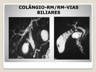 COLÂNGIO-RM/RM-VIAS
BILIARES
 