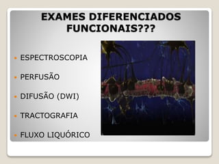 EXAMES DIFERENCIADOS
FUNCIONAIS???
 ESPECTROSCOPIA
 PERFUSÃO
 DIFUSÃO (DWI)
 TRACTOGRAFIA
 FLUXO LIQUÓRICO
 