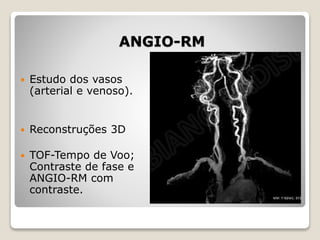 ANGIO-RM
 Estudo dos vasos
(arterial e venoso).
 Reconstruções 3D
 TOF-Tempo de Voo;
Contraste de fase e
ANGIO-RM com
contraste.
 
