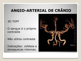 ANGIO-ARTERIAL DE CRÂNIO
 3D TOFF
 O sangue é o próprio
contraste
 Não utiliza contraste
 Indicações: cefaleia e
enxaquecas intensas.
 