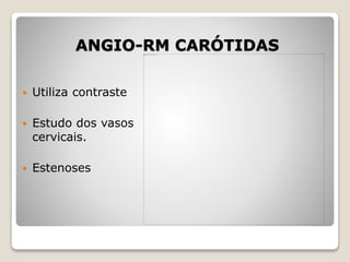 ANGIO-RM CARÓTIDAS
 Utiliza contraste
 Estudo dos vasos
cervicais.
 Estenoses
 