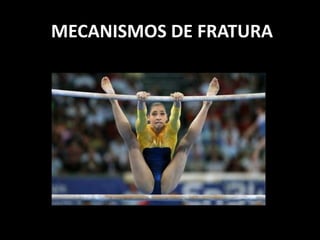 MECANISMOS DE FRATURA
 