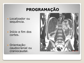 PROGRAMAÇÃO
 Localizador ou
sequência.
 Início e fim dos
cortes.
 Orientação:
caudocranial ou
craniocaudal.
 