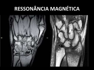 RESSONÂNCIA MAGNÉTICA
 