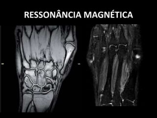 RESSONÂNCIA MAGNÉTICA
 
