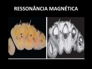 RESSONÂNCIA MAGNÉTICA
 
