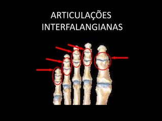 ARTICULAÇÕES
INTERFALANGIANAS
 