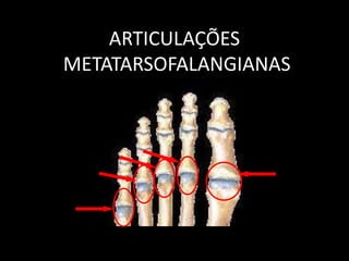 ARTICULAÇÕES
METATARSOFALANGIANAS
 
