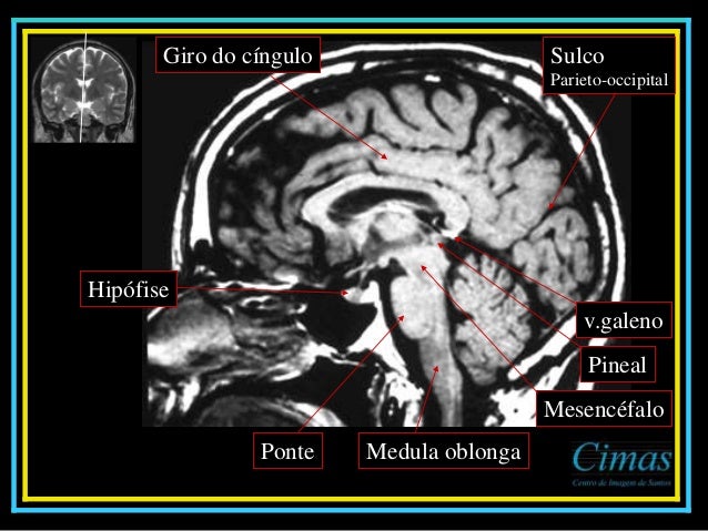 Exames de ressonancia magnetica