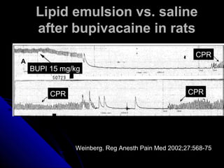 Lipid emulsion vs. saline
 after bupivacaine in rats
                                                 CPR
BUPI 15 mg/kg


     CPR                                       CPR




           Weinberg. Reg Anesth Pain Med 2002;27:568-75
 