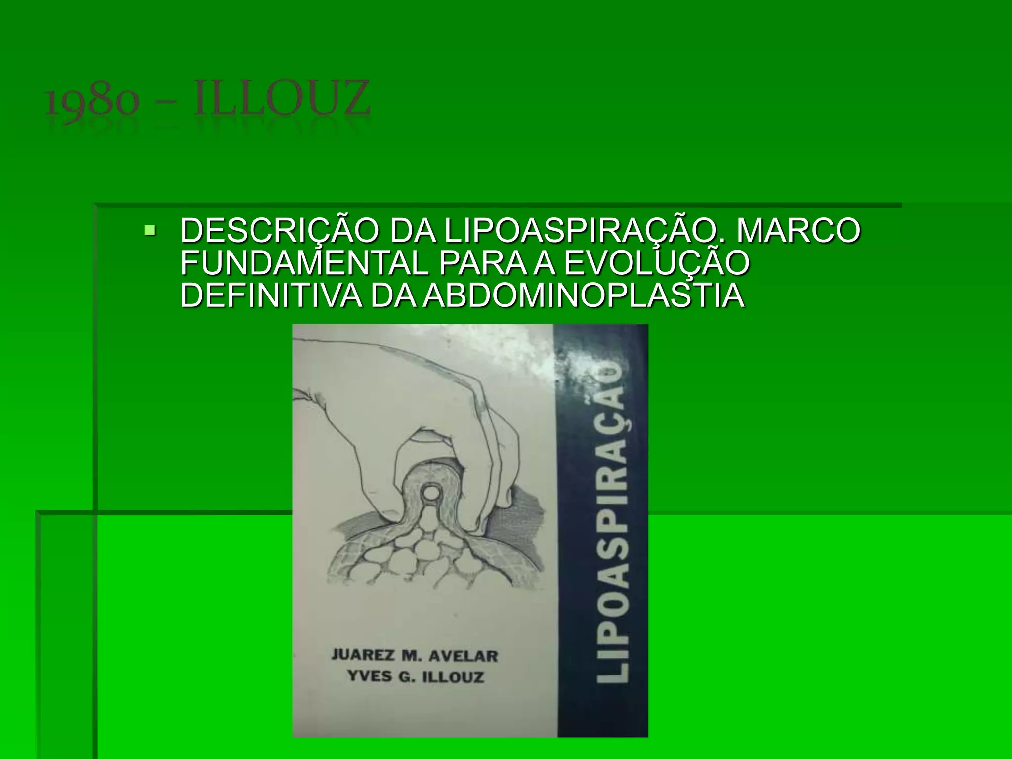  DESCRIÇÃO DA LIPOASPIRAÇÃO. MARCO
FUNDAMENTAL PARA A EVOLUÇÃO
DEFINITIVA DA ABDOMINOPLASTIA
 
