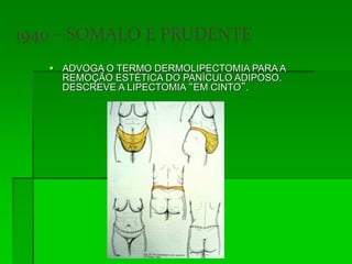  ADVOGA O TERMO DERMOLIPECTOMIA PARA A
REMOÇÃO ESTÉTICA DO PANÍCULO ADIPOSO.
DESCREVE A LIPECTOMIA “EM CINTO”.
 