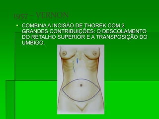  COMBINA A INCISÃO DE THOREK COM 2
GRANDES CONTRIBUIÇÕES: O DESCOLAMENTO
DO RETALHO SUPERIOR E A TRANSPOSIÇÃO DO
UMBIGO.
 