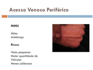 aulaacessosvenosos-140517001241-phpapp01.pdf