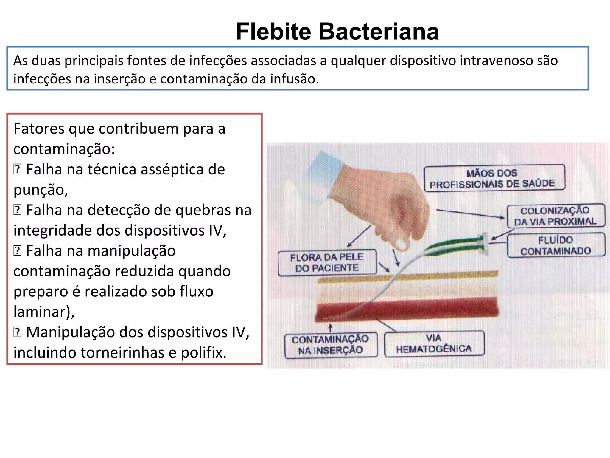 Flebite Bacteriana
Fatores que contribuem para a
contaminação:
􀂄 Falha na técnica asséptica de
punção,
􀂄 Falha na detecção de quebras na
integridade dos dispositivos IV,
􀂄 Falha na manipulação
contaminação reduzida quando
preparo é realizado sob fluxo
laminar),
􀂄 Manipulação dos dispositivos IV,
incluindo torneirinhas e polifix.
As duas principais fontes de infecções associadas a qualquer dispositivo intravenoso são
infecções na inserção e contaminação da infusão.
 