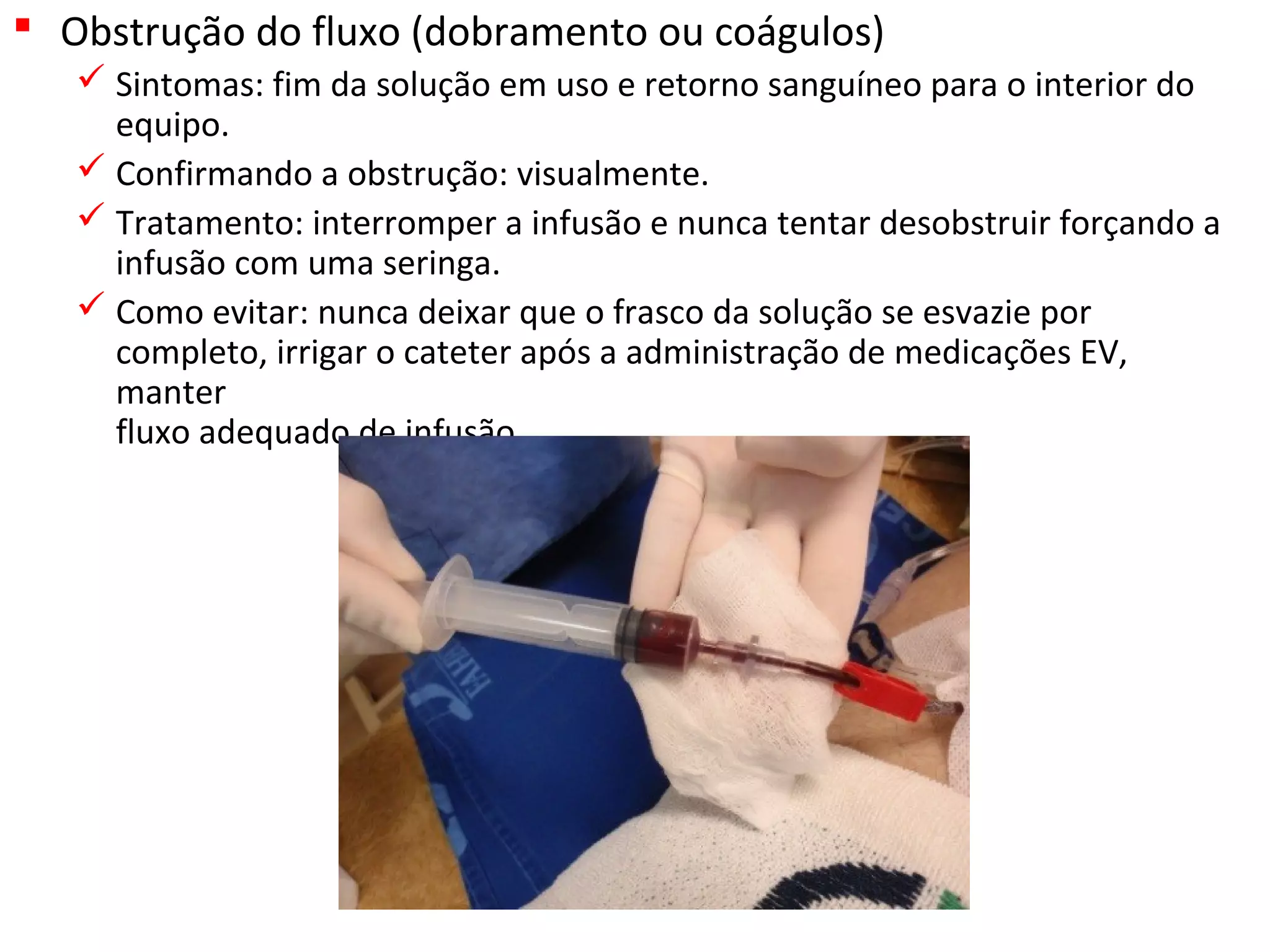  Obstrução do fluxo (dobramento ou coágulos)
 Sintomas: fim da solução em uso e retorno sanguíneo para o interior do
equipo.
 Confirmando a obstrução: visualmente.
 Tratamento: interromper a infusão e nunca tentar desobstruir forçando a
infusão com uma seringa.
 Como evitar: nunca deixar que o frasco da solução se esvazie por
completo, irrigar o cateter após a administração de medicações EV,
manter
fluxo adequado de infusão.
 