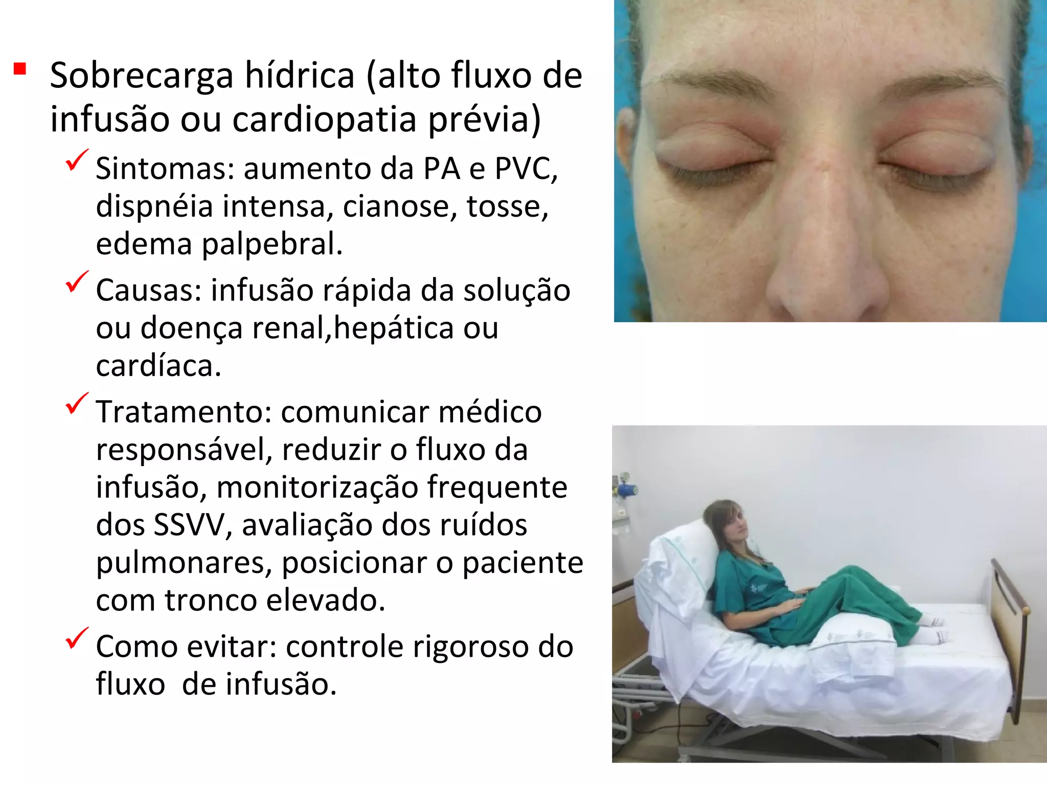  Sobrecarga hídrica (alto fluxo de
infusão ou cardiopatia prévia)
Sintomas: aumento da PA e PVC,
dispnéia intensa, cianose, tosse,
edema palpebral.
Causas: infusão rápida da solução
ou doença renal,hepática ou
cardíaca.
Tratamento: comunicar médico
responsável, reduzir o fluxo da
infusão, monitorização frequente
dos SSVV, avaliação dos ruídos
pulmonares, posicionar o paciente
com tronco elevado.
Como evitar: controle rigoroso do
fluxo de infusão.
 