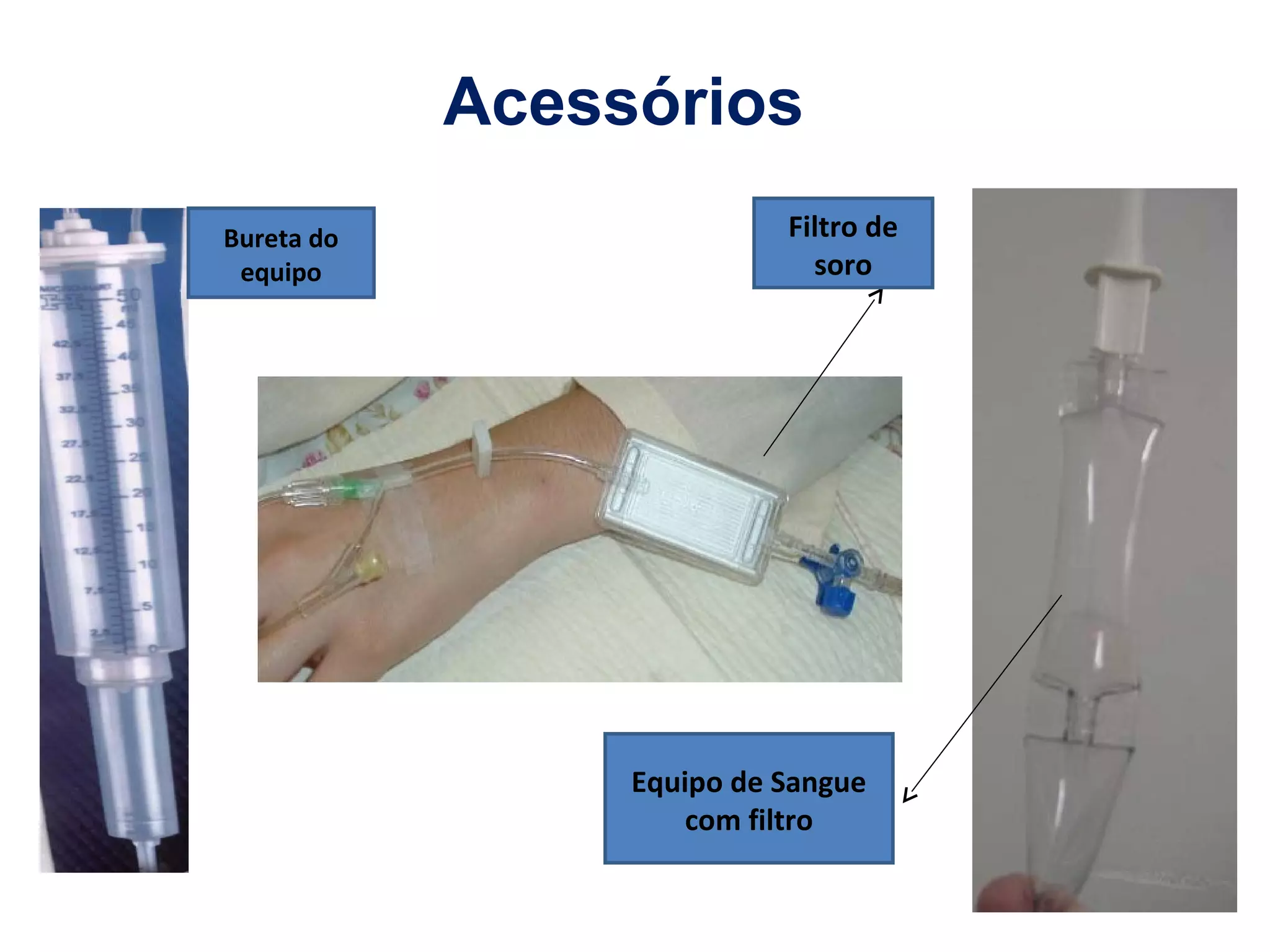 Acessórios
Bureta do
equipo
Filtro de
soro
Equipo de Sangue
com filtro
 