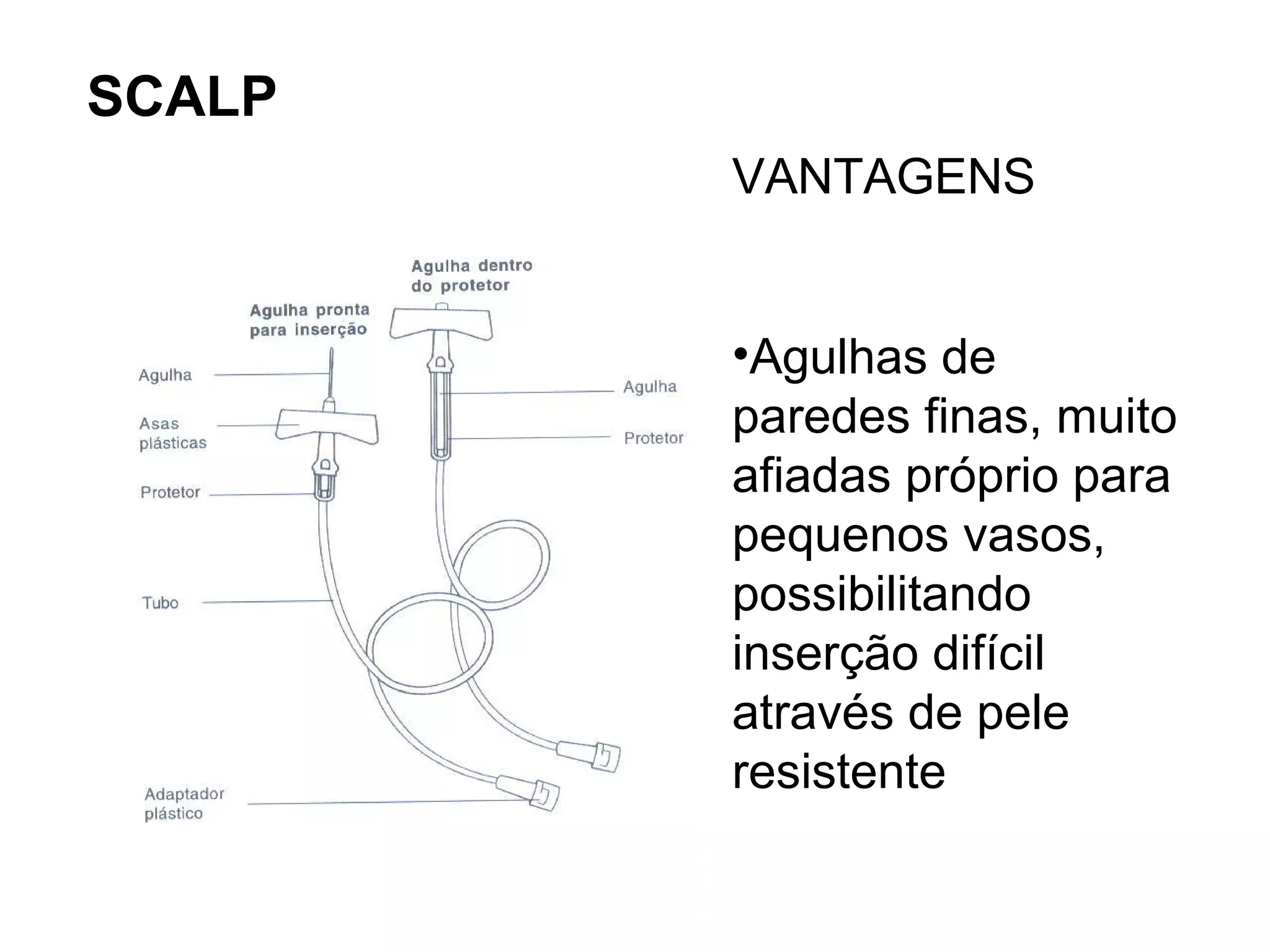 SCALP
VANTAGENS
•Agulhas de
paredes finas, muito
afiadas próprio para
pequenos vasos,
possibilitando
inserção difícil
através de pele
resistente
 