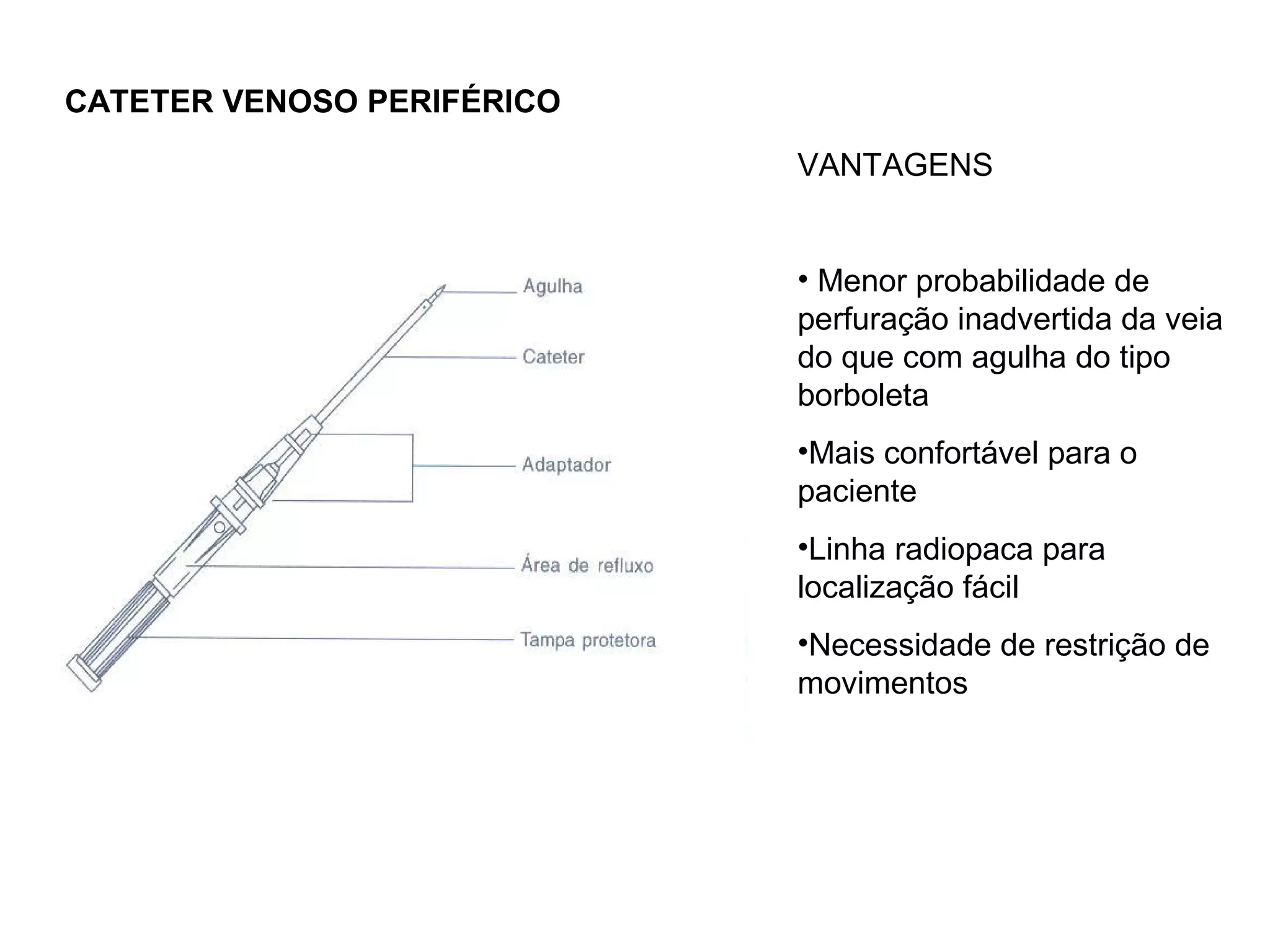 CATETER VENOSO PERIFÉRICO
VANTAGENS
• Menor probabilidade de
perfuração inadvertida da veia
do que com agulha do tipo
borboleta
•Mais confortável para o
paciente
•Linha radiopaca para
localização fácil
•Necessidade de restrição de
movimentos
 