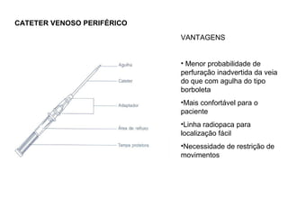 CATETER VENOSO PERIFÉRICO
VANTAGENS
• Menor probabilidade de
perfuração inadvertida da veia
do que com agulha do tipo
borboleta
•Mais confortável para o
paciente
•Linha radiopaca para
localização fácil
•Necessidade de restrição de
movimentos
 