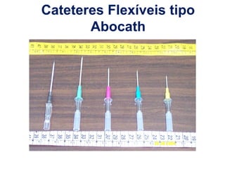 Cateteres Flexíveis tipo
Abocath
 