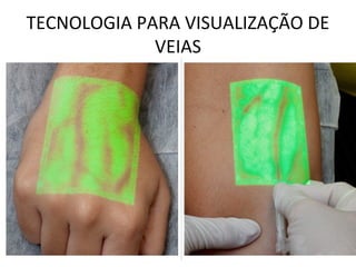 TECNOLOGIA PARA VISUALIZAÇÃO DE
VEIAS
 