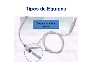 Tipos de Equipos
Equipo com Injetor
Lateral
 
