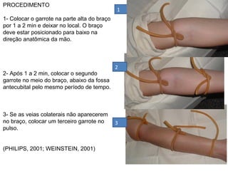 PROCEDIMENTO
1- Colocar o garrote na parte alta do braço
por 1 a 2 min e deixar no local. O braço
deve estar posicionado para baixo na
direção anatômica da mão.
2- Após 1 a 2 min, colocar o segundo
garrote no meio do braço, abaixo da fossa
antecubital pelo mesmo período de tempo.
3- Se as veias colaterais não aparecerem
no braço, colocar um terceiro garrote no
pulso.
(PHILIPS, 2001; WEINSTEIN, 2001)
1
2
3
 