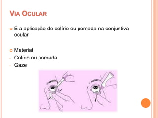  É a aplicação de colírio ou pomada na conjuntiva
ocular
 Material
- Colírio ou pomada
- Gaze
VIA OCULAR
 