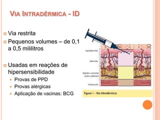 VIA INTRADÉRMICA - ID
 Via restrita
 Pequenos volumes – de 0,1
a 0,5 mililitros
 Usadas em reações de
hipersensibilidade
 Provas de PPD
 Provas alérgicas
 Aplicação de vacinas: BCG
 