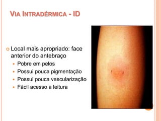 VIA INTRADÉRMICA - ID
 Local mais apropriado: face
anterior do antebraço
 Pobre em pelos
 Possui pouca pigmentação
 Possui pouca vascularização
 Fácil acesso a leitura
 