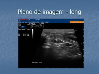 Plano de imagem - long
 