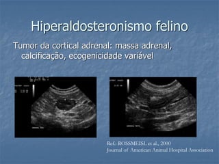 Hiperaldosteronismo felino
Tumor da cortical adrenal: massa adrenal,
calcificação, ecogenicidade variável
Ref.: ROSSMEISL et al., 2000
Journal of American Animal Hospital Association
 