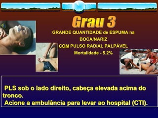 GRANDE QUANTIDADE de ESPUMA na
BOCA/NARIZ
COM PULSO RADIAL PALPÁVEL
Mortalidade - 5.2%
PLS sob o lado direito, cabeça elevada acima do
tronco.
Acione a ambulância para levar ao hospital (CTI).
 