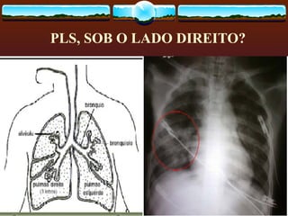 PLS, SOB O LADO DIREITO?
 