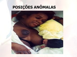 POSIÇÕES ANÔMALAS
 