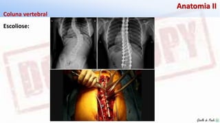 Giselle de PaulaGiselle de Paula
Anatomia II
Escoliose:
Coluna vertebral
 