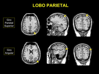 LOBO PARIETAL


 Giro
Parietal
Superior




 Giro
Angular
 