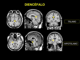DIENCÉFALO




               TÁLAMO




             HIPOTÁLAMO
 