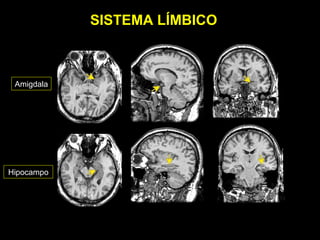 SISTEMA LÍMBICO



 Amigdala




Hipocampo
 