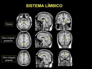 SISTEMA LÍMBICO



   Fórnix




Giro cíngulo
 posterior




Giro cíngulo
  anterior
 