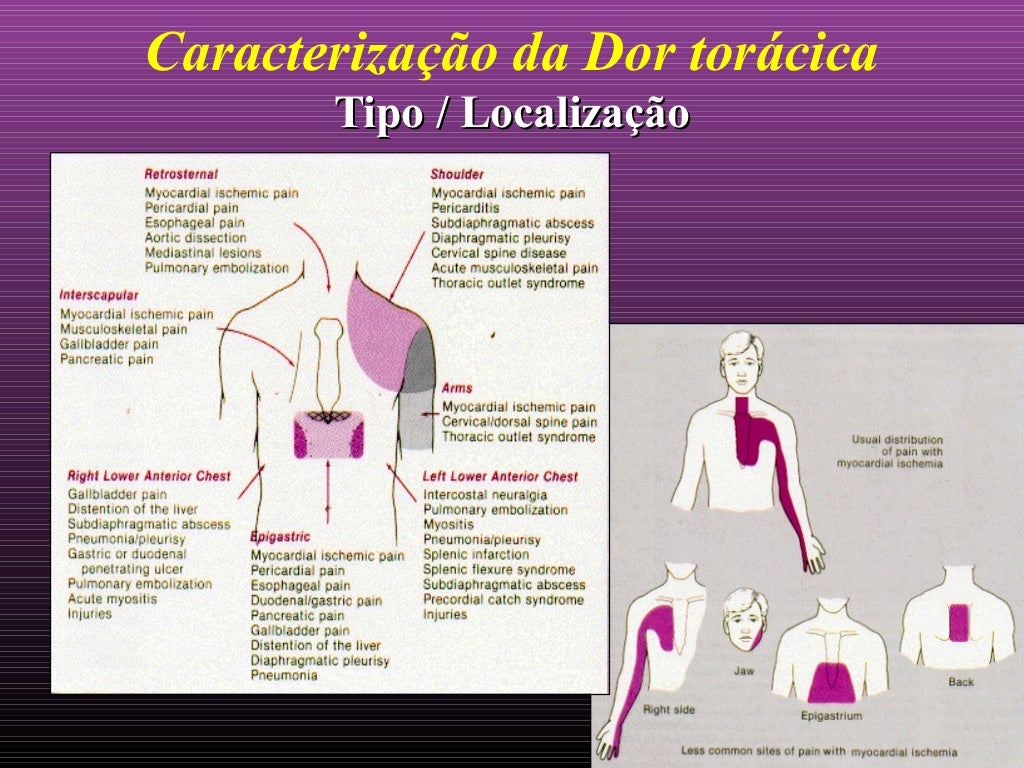 Manuseio da Dor Torácica no PS