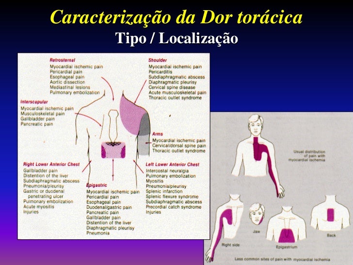 Manuseio Da Dor Tor cica No PS manuseio-da-dor-tor-cica-no-ps