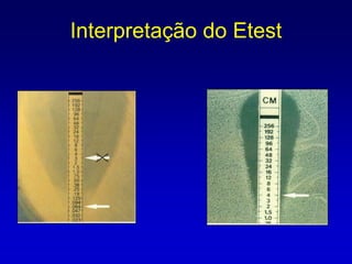 TESTE DE DIFUSÃO EM ÁGARAplicação dos discos  Bateria pré determinada