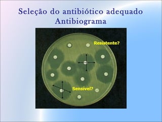 Seleção do antibiótico adequado
Antibiograma
 